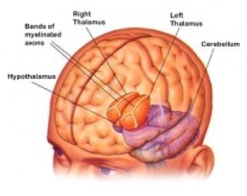 hypothalamus